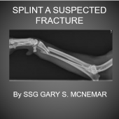 Suspected Fracture